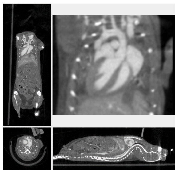 心臟門(mén)控成像.png 心臟門(mén)控成像.png